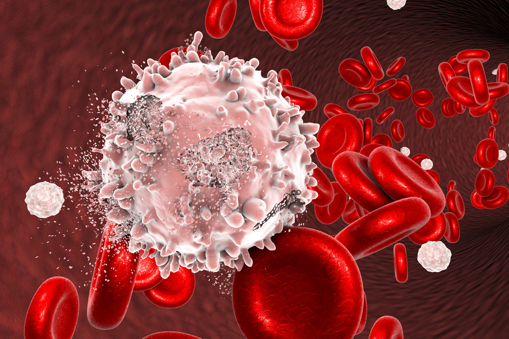 chronic phase philadelphia chromosome positive chronic myelocytic leukemia