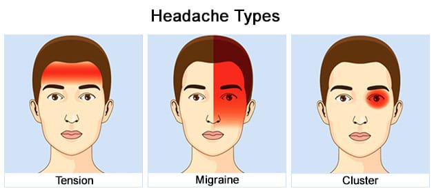 cluster headache prevention