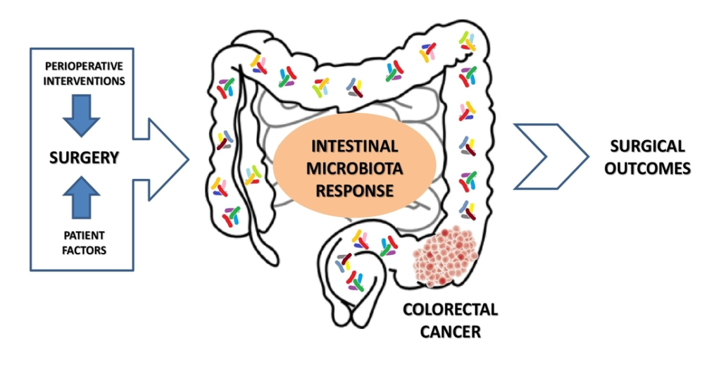 colorectal perioperative infection