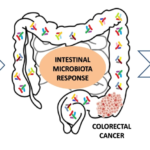 colorectal perioperative infection