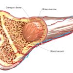 conditioning prior to allogeneic hematopoietic stem cell transplant