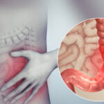 constipation predominant irritable bowel