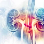 contrast media-induced nephrotoxicity prevention