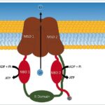 cystic fibrosis with heterozygous f508del mutation in cftr gene