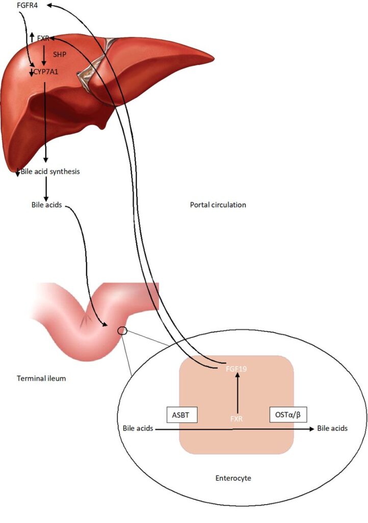 deficiency of bile acids in bile acid synthesis disorder