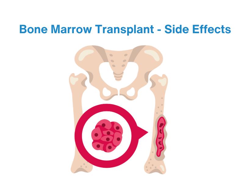 delay or failure of allogenic bone marrow transplant