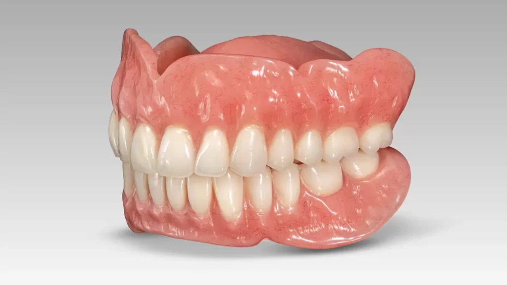 denture stomatitis