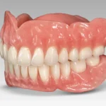 denture stomatitis