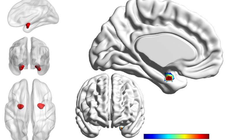 depression associated with bipolar disorder