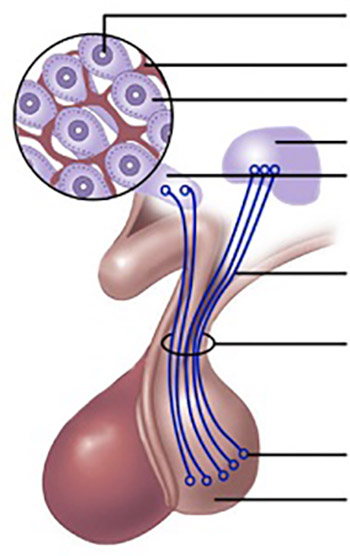 diabetes insipidus