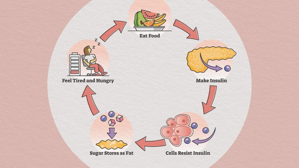 diabetes mellitus with severe insulin resistance