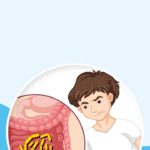 diabetic gastroparesis