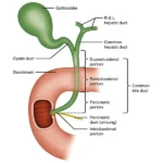 diagnostic aid for biliary tract