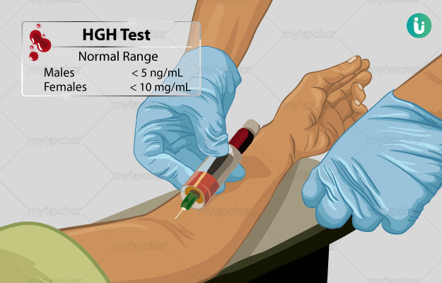 diagnostic test for growth hormone secretion