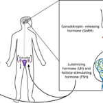 diagnostic test for hypothalamic pituitary gonadal axis