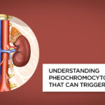 diagnostic test for pheochromocytoma