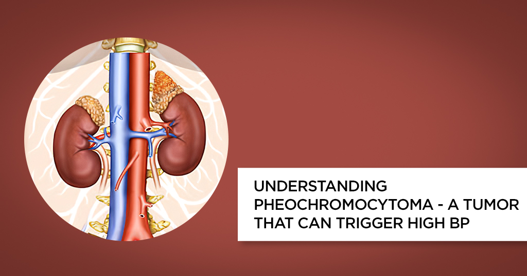 diagnostic test for pheochromocytoma