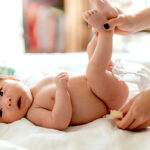 diaper rash causes, diaper rash treatment, diaper rash prevention, diaper dermatitis, baby skin care