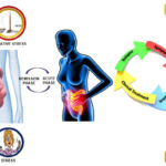 diarrhea secondary to inflammatory bowel disease