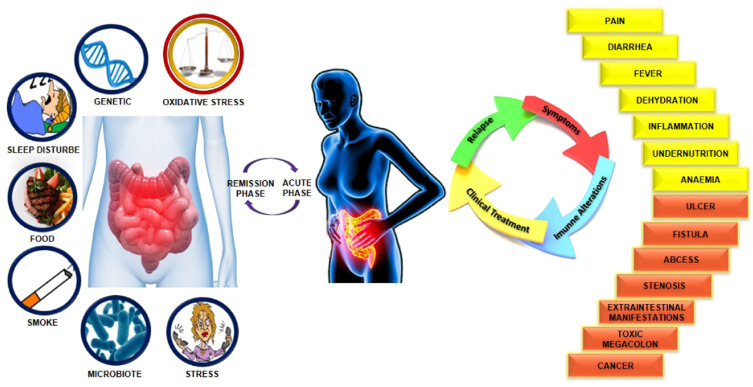 diarrhea secondary to inflammatory bowel disease