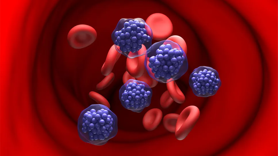 diffuse large b-cell lymphoma