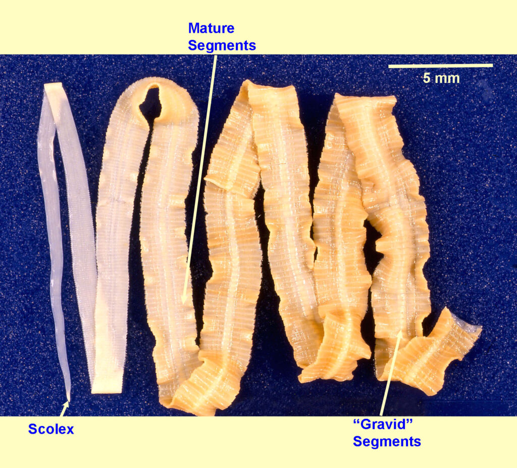 diphyllobothrium infections