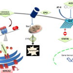 doxorubicin-induced cardiomyopathy