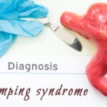 dumping syndrome