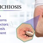 ehrlichiosis