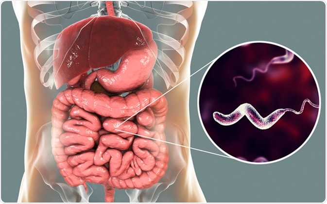 enteric campylobacteriosis