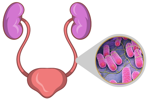 enterobacter cloacae urinary tract infection