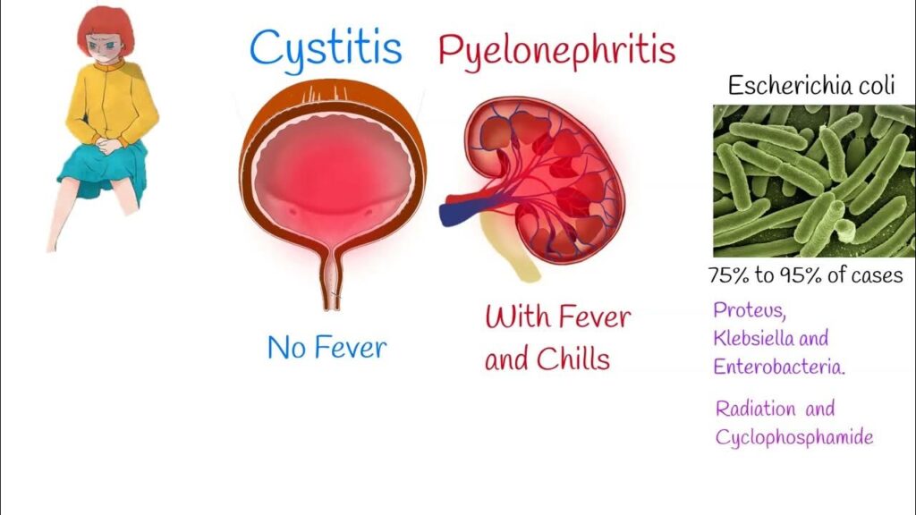 enterobacter cystitis