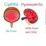 enterobacter cystitis