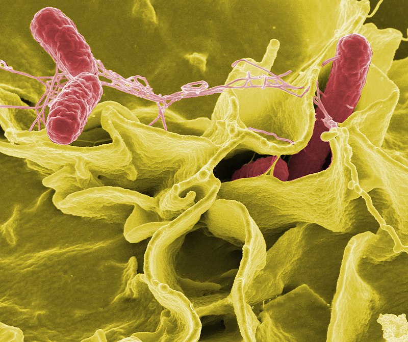 enterobacter endometritis