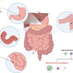 enterobacter peritonitis