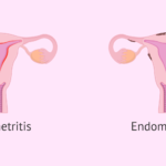 enterococcus endometritis