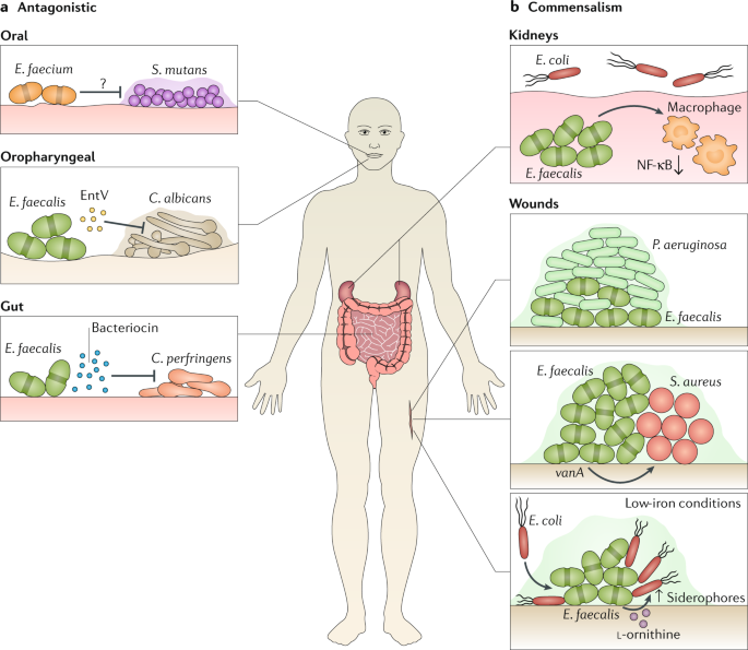 enterococcus joint infection