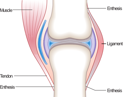 enthesitis-related juvenile idiopathic arthritis