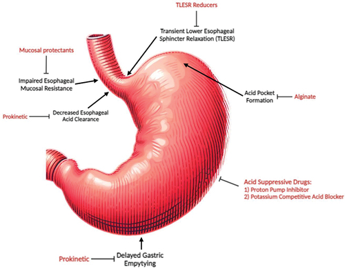 erosive esophagitis