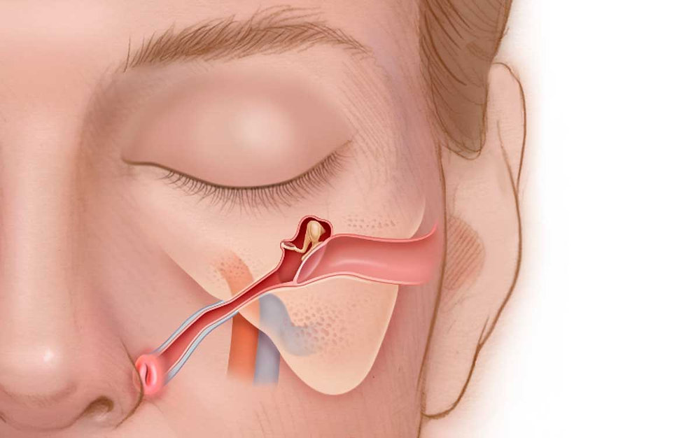 eustachian tube congestion