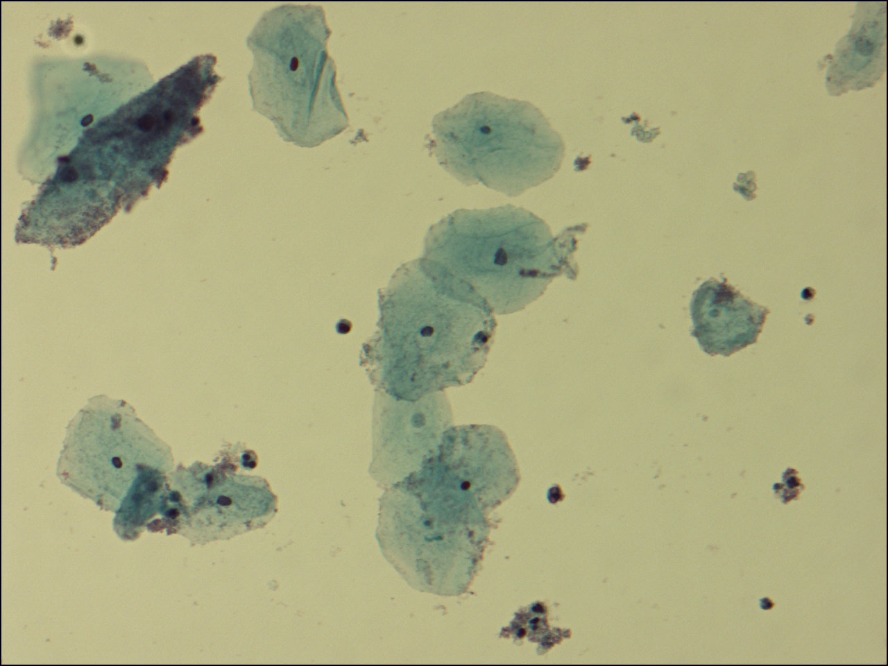 gardnerella vaginalis bacterial vaginosis