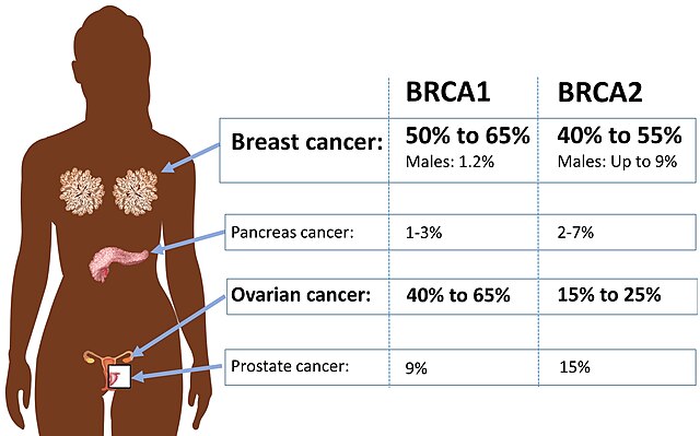 germline brca mutated, her2 negative breast cancer