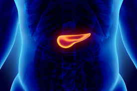 germline brca-mutated metastatic pancreatic adenocarcinoma