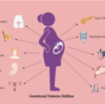 gestational diabetes mellitus