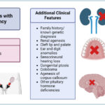 gonadotropin releasing factor deficiency