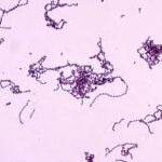 gram negative aerobic bacilli pneumonia