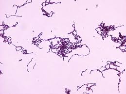 gram negative aerobic bacilli pneumonia