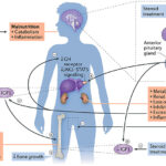 growth failure secondary to chronic renal failure