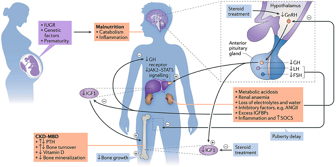 growth failure secondary to chronic renal failure