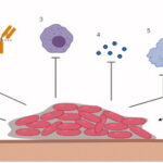 haemophilus influenzae chronic bronchitis